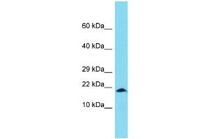 Host: Rabbit Target Name: XAGE1B Sample Type: OVCAR-3 Whole Cell lysates Antibody Dilution: 1.