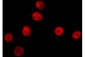 ABIN6277499 staining  NIH-3T3 cells by IF/ICC. (ERCC1 antibody  (Internal Region))