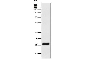 Western blot analysis of VAMP1 expression in Human cerebellum lysate.