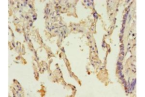 Immunohistochemistry of paraffin-embedded human lung tissue using ABIN7142610 at dilution of 1:100