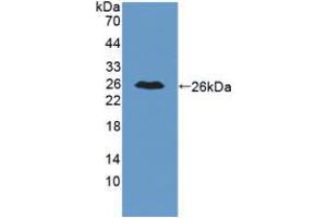 Western blot analysis of recombinant Mouse IL34. (IL-34 antibody  (AA 21-235))