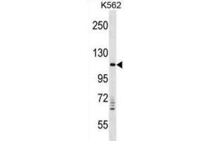 Western Blotting (WB) image for anti-Vacuolar Protein Sorting 11 Homolog (VPS11) antibody (ABIN2998786) (VPS11 antibody)