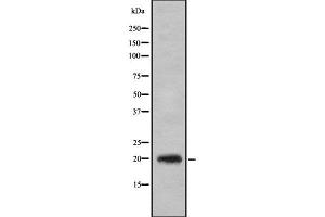 Western blot analysis of CD3G using HT29 whole cell lysates