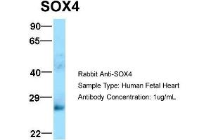 Host: Rabbit  Target Name: SOX4  Sample Tissue: Human Fetal Heart  Antibody Dilution: 1. (SOX4 antibody  (N-Term))