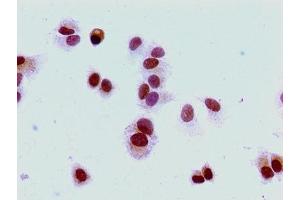 Immunocytochemistry analysis of MCF-7 cells using ABIN7139274 at dilution of 1:100 (HIST1H1E antibody  (2meLys16))