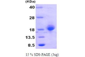 SDS-PAGE (SDS) image for Growth Arrest and DNA-Damage-Inducible, beta (GADD45B) (AA 1-160) protein (ABIN666871) (GADD45B Protein (AA 1-160))