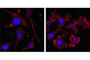 Confocal immunofluorescence analysis of SKBR-3 (left) and A549 (right) cells using beta Actin mouse mAb (red, the secondary Ab is Cy3-Goat anti mouse IgG). (beta Actin antibody)