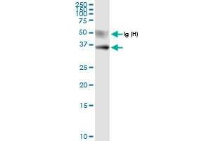Immunoprecipitation of USP18 transfected lysate using anti-USP18 MaxPab rabbit polyclonal antibody and Protein A Magnetic Bead , and immunoblotted with USP18 MaxPab rabbit polyclonal antibody (D01) . (USP18 antibody  (AA 1-372))