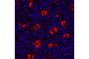Immunofluorescence (IF) image for anti-CD68 Molecule (CD68) antibody (ABIN7449045) (Recombinant CD68 antibody)