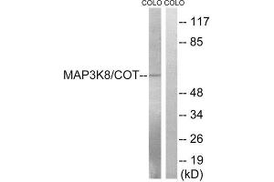 Western Blotting (WB) image for anti-Mitogen-Activated Protein Kinase Kinase Kinase 8 (MAP3K8) (Ser400) antibody (ABIN1848230) (MAP3K8 antibody  (Ser400))
