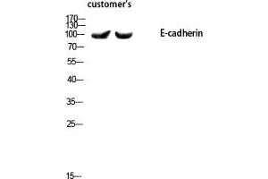 Western blot analysis of customer's using E-cadherin Polyclonal Antibody diluted at 1:1000. (E-cadherin antibody  (AA 1-80))