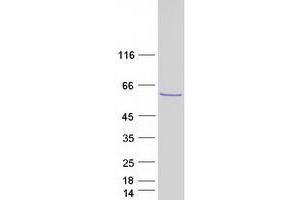 TBL1Y Protein (Transcript Variant 3) (Myc-DYKDDDDK Tag)