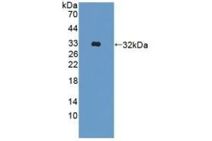 Detection of Recombinant ADAM33, Human using Polyclonal Antibody to A Disintegrin And Metalloprotease 33 (ADAM33) (ADAM33 antibody  (AA 210-503))