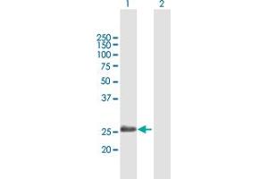Western Blot analysis of ADH6 expression in transfected 293T cell line by ADH6 MaxPab polyclonal antibody. (ADH6 antibody  (AA 1-295))