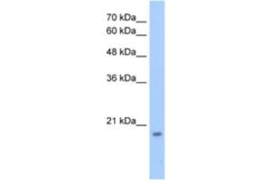 Western Blotting (WB) image for anti-Deoxynucleotidyltransferase, Terminal, Interacting Protein 1 (DNTTIP1) antibody (ABIN2463366) (DNTTIP1 antibody)