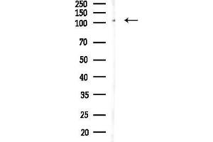 anti-MMS19 Nucleotide Excision Repair Homolog (MMS19) (Internal Region) antibody