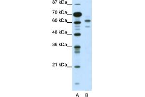 WB Suggested Anti-ZSCAN2 Antibody Titration:  0. (ZSCAN2 antibody  (N-Term))