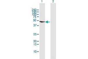 Western Blot analysis of UCKL1 expression in transfected 293T cell line by UCKL1 MaxPab polyclonal antibody. (UCKL1 antibody  (AA 1-419))