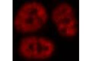 ABIN6269115 staining A549 by IF/ICC. (SP1 antibody  (C-Term))