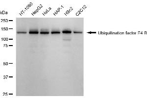 Western blotting analysis using Ubiquitination factor E4 B antibody (ABIN7800713). (Recombinant UBE4B antibody)