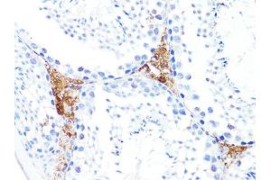 Immunohistochemistry of paraffin-embedded mouse testis using S100A10 antibody. (S100A10 antibody)
