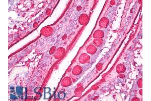 Immunohistochemistry staining of human small intestine (paraffin sections) using anti-blood group Lewis b (clone 2-25LE). (Blood Group Lewis B antibody)