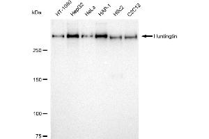 Western blotting analysis using Huntingtin antibody (ABIN7799005).