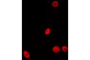 ABIN6275533 staining Hela by IF/ICC. (PDIK1L antibody  (Internal Region))