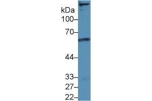Western blot analysis of Mouse Cerebrum lysate, using Rat LDLR Antibody (5 µg/ml) and HRP-conjugated Goat Anti-Rabbit antibody ( (LDLR antibody  (AA 335-588))