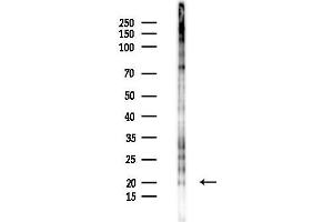 anti-Inhibitor of DNA Binding 2 (Id2) (pThr27) antibody