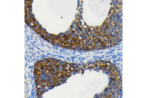 Immunohistochemistry of paraffin-embedded rat ovary using cI antibody  at dilution of 1:100 (40x lens). (BIRC2 antibody)