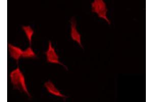 ABIN6274324 staining COLO205 by IF/ICC. (Meningioma 1 antibody  (Internal Region))
