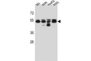 Western Blotting (WB) image for anti-Tubulin, beta 8 (TUBB8) antibody (ABIN2997238) (Tubulin, beta 8 antibody)