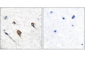 Immunohistochemistry analysis of paraffin-embedded human brain, using IL-3R beta (Phospho-Tyr593) Antibody. (CSF2RB2 antibody  (pTyr593))