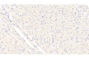 Detection of CTGF in Human Cardiac Muscle Tissue using Polyclonal Antibody to Connective Tissue Growth Factor (CTGF) (CTGF antibody  (AA 248-349))