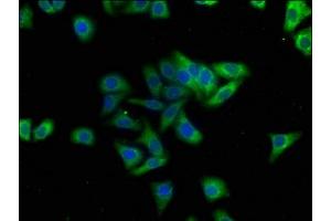 Immunofluorescence staining of HepG2 cells with ABIN7167409 at 1:100, counter-stained with DAPI.