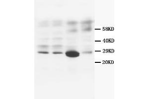 Western Blotting (WB) image for anti-Calbindin (CALB1) antibody (ABIN1105634) (CALB1 antibody)