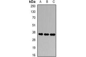 Western blot analysis of CDK6 expression in SW620 (A), Hela (B), Jurkat (C) whole cell lysates. (CDK6 antibody)