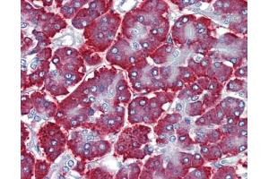 Immunohistochemistry (IHC) image for anti-FEZ Family Zinc Finger 1 (FEZF1) (C-Term) antibody (ABIN2784171) (FEZF1 antibody  (C-Term))