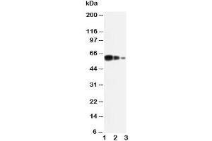 Western blot testing of ADAM10 antibody and Lane 1:  recombinant human protein 10ng;  2: 5ng;  3:  2.