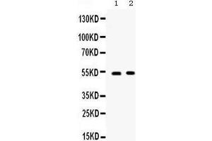 Western blot analysis of CD134/OX40 expression in SW620 whole cell lysates (lane 1) and 22RV1 whole cell lysates (lane 1). (TNFRSF4 antibody  (C-Term))