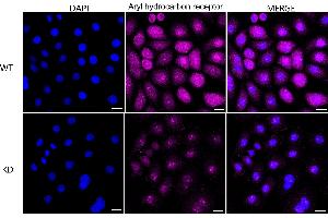 Immunocytochemical staining of HeLa cells using Aryl hydrocarbon receptor antibody (ABIN7798235), 1:1,000), Top panel: wild-type (WT), Bottom panal: Aryl hydrocarbon receptor shRNA knockdown (KD).