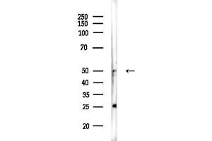Western blot analysis of lysates from EC304 cells, using FOX Antibody at 1/1000 dilution.