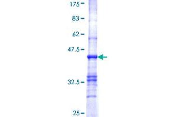 PDHB Protein (AA 250-359) (GST tag)