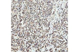 IHC analysis of EEA1 using anti-EEA1 antibody (ABIN5692856). (EEA1 antibody)
