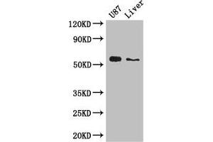 Western Blot Positive WB detected in: U87 whole cell lysate, Mouse liver tissue All lanes: ALDH1A3 antibody at 3 μg/mL Secondary Goat polyclonal to rabbit IgG at 1/50000 dilution Predicted band size: 57 kDa Observed band size: 57 kDa (ALDH1A3 antibody  (AA 2-210))