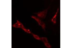 ABIN6278586 staining RAW264. (KLHL3 antibody  (N-Term))