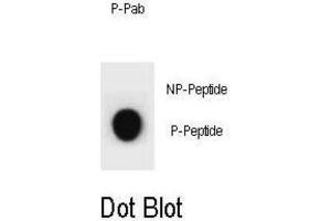 Dot Blot (DB) image for anti-Cyclin B2 (CCNB2) (pSer392) antibody (ABIN3002074)