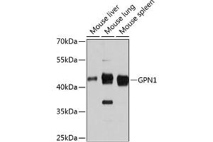 Western blot analysis of extracts of various cell lines, using GPN1 antibody (ABIN6133308, ABIN6141341, ABIN6141342 and ABIN6215758) at 1:3000 dilution. (GPN1 antibody  (AA 269-388))