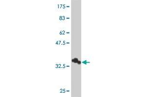 Western Blot detection against Immunogen (34. (Spectrin, Beta, Non-erythrocytic 2 (SPTBN2) (AA 643-720) antibody)